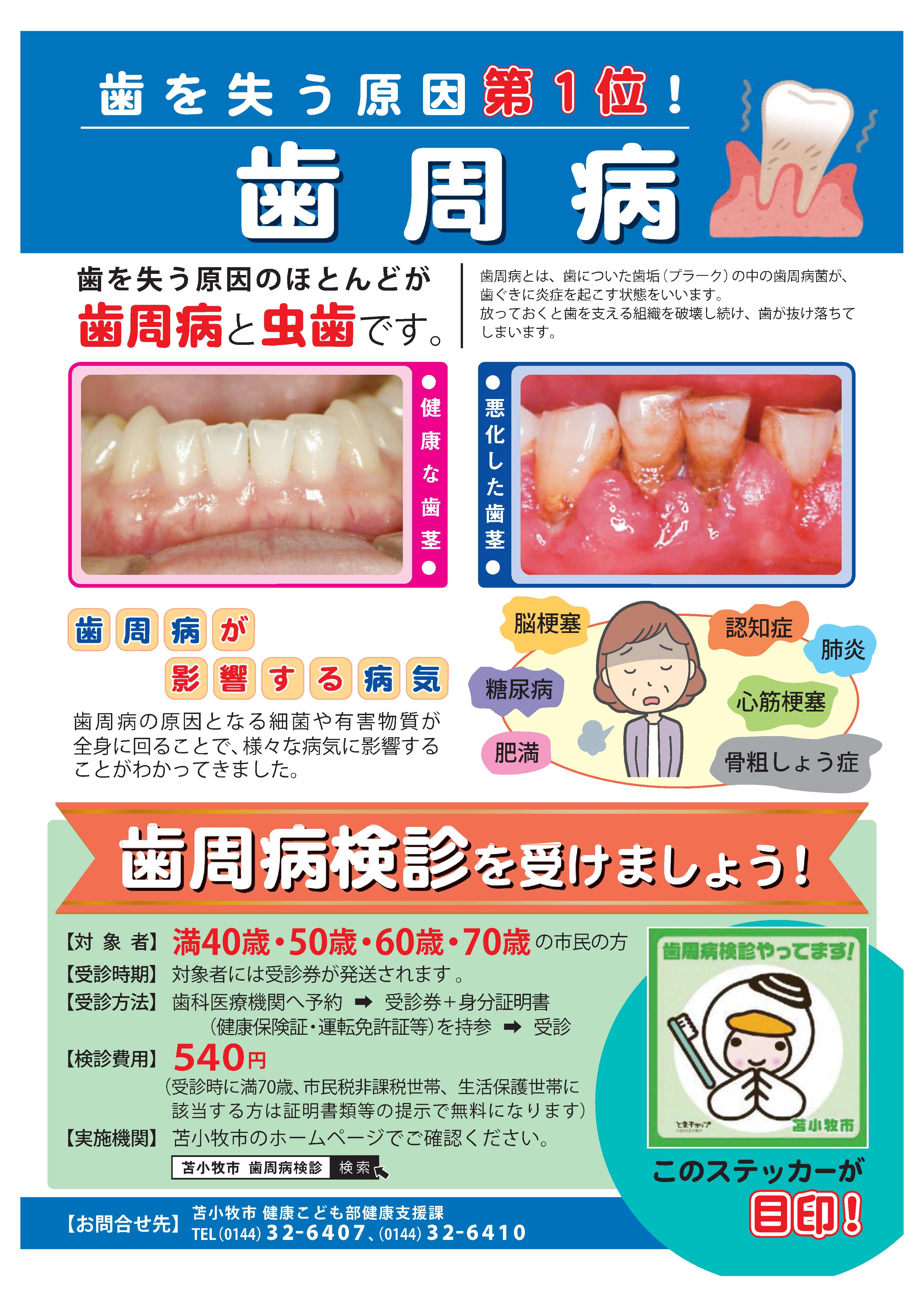 歯周病検診の実施について 北海道苫小牧市 歯周病検診の実施について 北海道苫小牧市